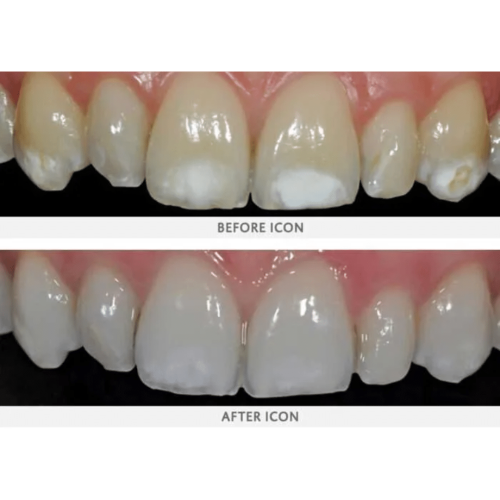 Stains Smile Arc Pediatric Dentistry in San Diego, CA